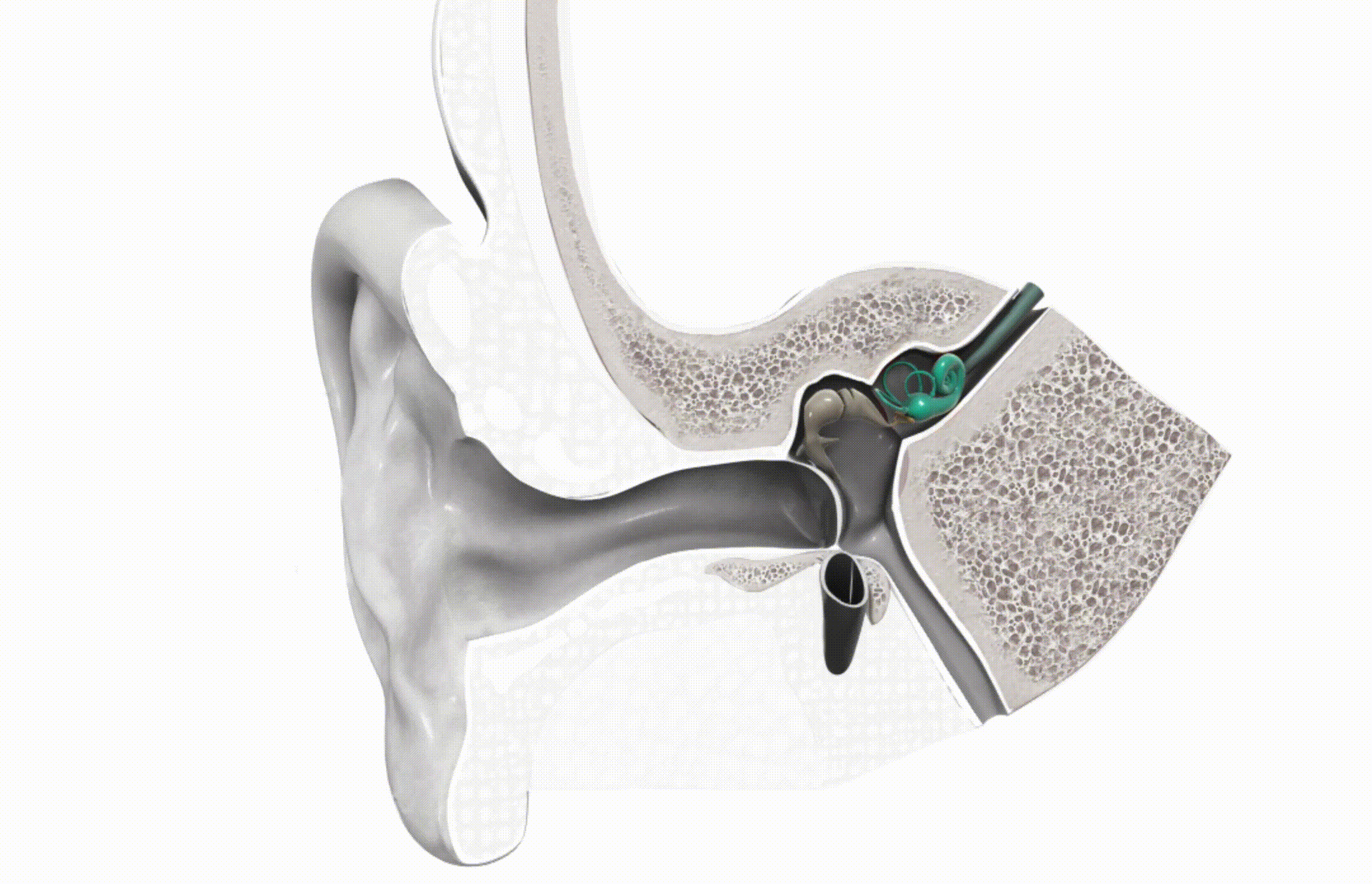 Bone-Conduction